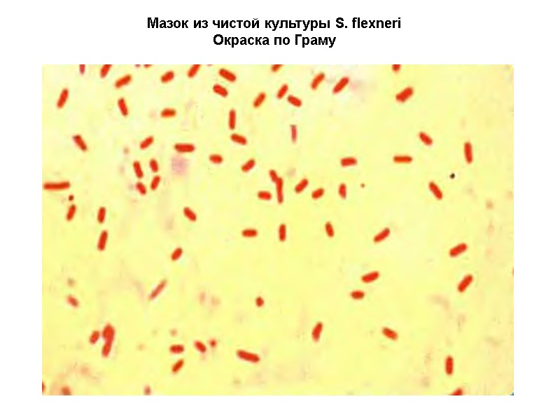 Мазок из чистой культуры S. flexneri Окраска по Граму